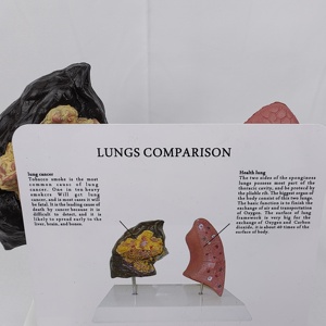 Comparison Model Between Normal Human Lungs Smoking/Drug-Using Lungs Medical Science Product Comprehensive <strong>Explanation</strong> Basis - Product Image 4