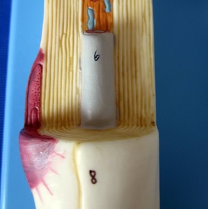 Allargamento del corpo delle cellule neuronali e della struttura delle Fiber nervose nel modello medico del sistema di anatomia umana - Product Image 3