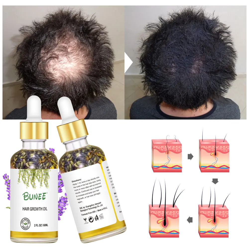 Kendi etiket organik saç çıkma tedavisi yeniden büyüme Serum Anti saç dökülmesi lavanta saç büyüme yağı inşa
