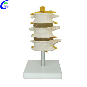 医学解剖学脊椎モデル人体解剖学3D脊椎モデル - Product Image 6