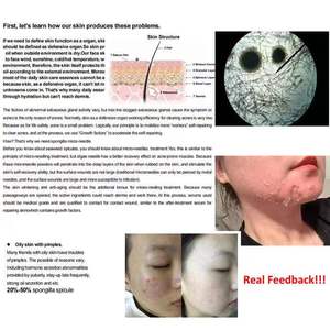 免费送货III型类人多胶原球，用于PMPS微针治疗 - Product Image 4