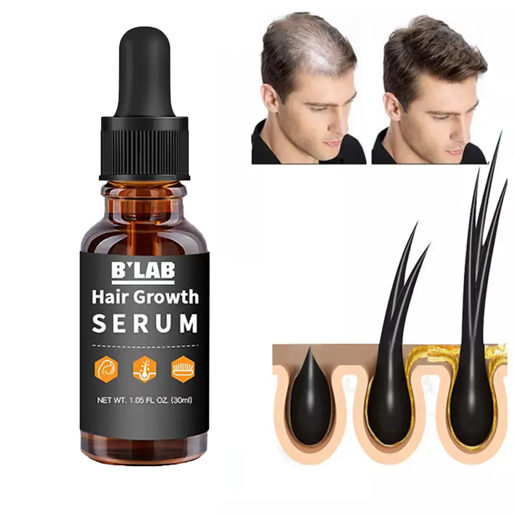 Bestseller 30ml Private Label Beste Haar behandlung BIOTIN Collagen Fast Hair Growth Serum