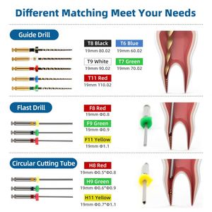 Phá vỡ loại bỏ tập tin công cụ extractor nội nha kênh gốc tập tin extractor hệ thống endo extractor - Product Image 5