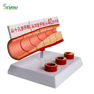 SCIEDU Age <strong>Group</strong> Large Blood Vessel Model 4 Parts <strong>Human</strong> Anatomy Model Sclerosis Cardiovascular Arteriosclerosis Pathology Model