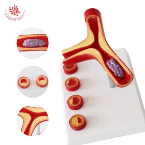 Human Pathology Blood Vessel Model Medical Anatomical Artey Model Medical Teaching Blood Vessels Model - Product Image 3