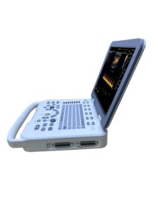 रंग डॉपलर अल्ट्रासाउंड सिस्टम सटीक निदान के लिए पशु चिकित्सा नैदानिक उपकरण - Product Image 2