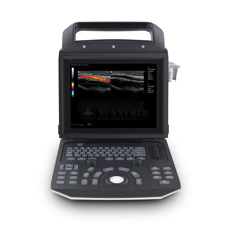 SYA-M5 Color Doppler Laptop Cardiac Ultrasound System Portable Zoncare M5 Medical Ultrasonic Equipment