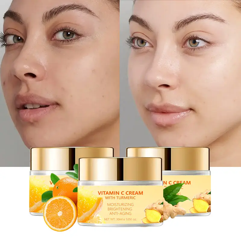 Peau blanche raffermissante hydratante anti-âge acide kojique curcuma vitamine c crème hydratante crème pour le visage