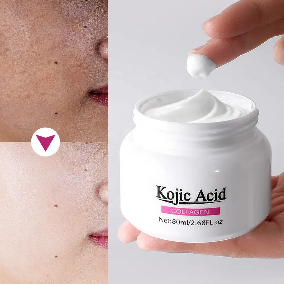 Creme removedor de rugas faciais para cuidados com a pele de marca própria, ácido kójico, colágeno, clareador da pele, creme anti-idade para pele negra