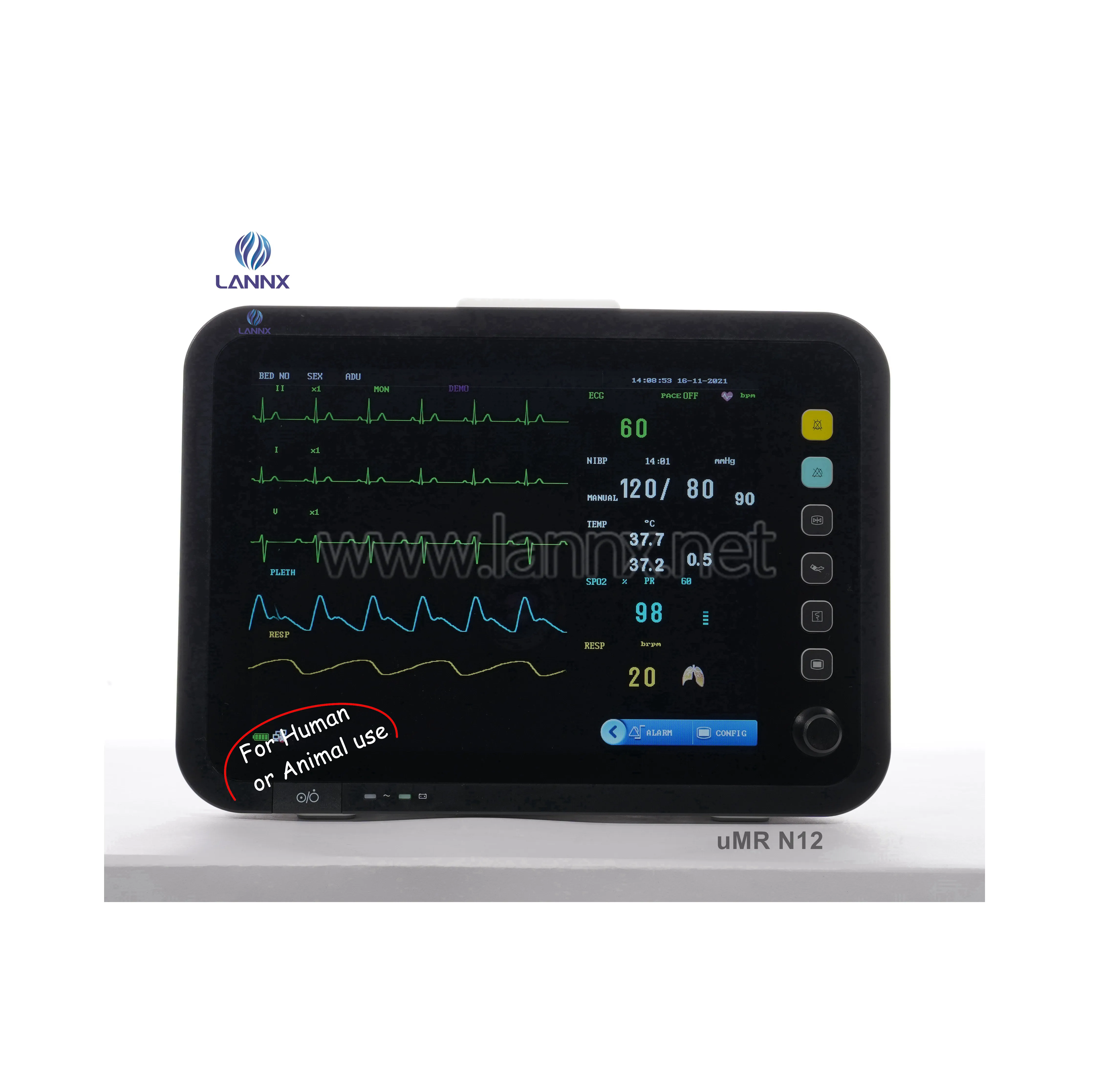 LANNX uMR N12 Hospital ICU clínico multifunción uso de animales humanos pacients Monitor pantalla táctil monitoreo de signos vitales médicos