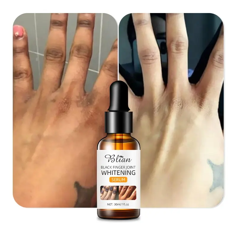 Kustom Label pribadi Serum pemutih Knuckle gelap untuk jari ketiak intim Area dada lutut siku