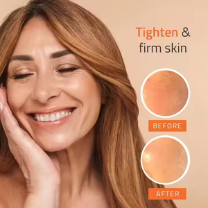 Private Label Natural <strong>Vit</strong> C &amp; <strong>Vit</strong> E Dark Spot Remover Facial Serum with Hyaluronic Acid Skin Brightening Serum - Product Image 5