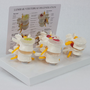 SCIEDU Teaching Resource Medical <strong>Human</strong> Skeleton Model Comparative Model of 4-stage Pathological Lumbar Spine with <strong>Back</strong> Card - Product Image 3