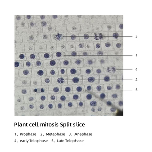תא הצמח mitosis frt1001 קצה שורש בצל לזהות את מורפולוגיה, המיקום ומספר הכרומוזומים בתאים