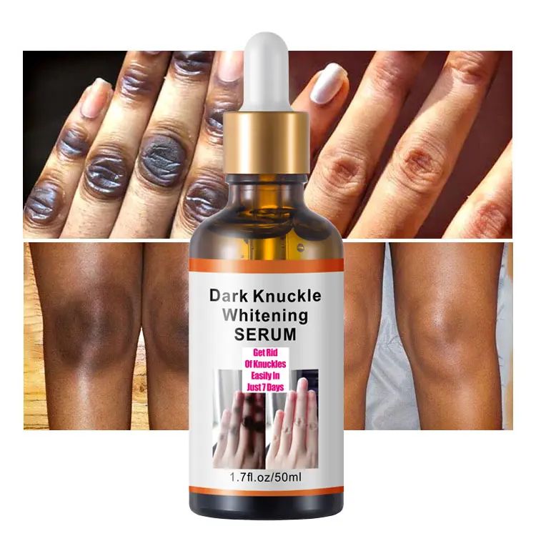 Dark Knuckles Sérum blanchissant rapide Correcteurs de pigmentation Main Knuckle Coudes Genou Sérum anti-taches intenses