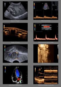 Baixo preço alta qualidade Mindray ultra-som máquina Mindray DC 40 trole cor <span class=keywords><strong>doppler</strong></span> ultra-som - Product Image 6