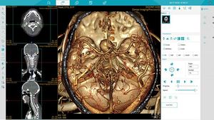 Medsinglong bilgisayar tomografisi 32-dilim spektral görüntüleme 2D 3D CT tarayıcı CT makinesi - Product Image 5