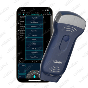 MSK <span class=keywords><strong>ultrasound</strong></span> adalah integral dari penilaian neuromusculette komprehensif untuk memandu rencana perawatan rehabilitasi - Product Image 5