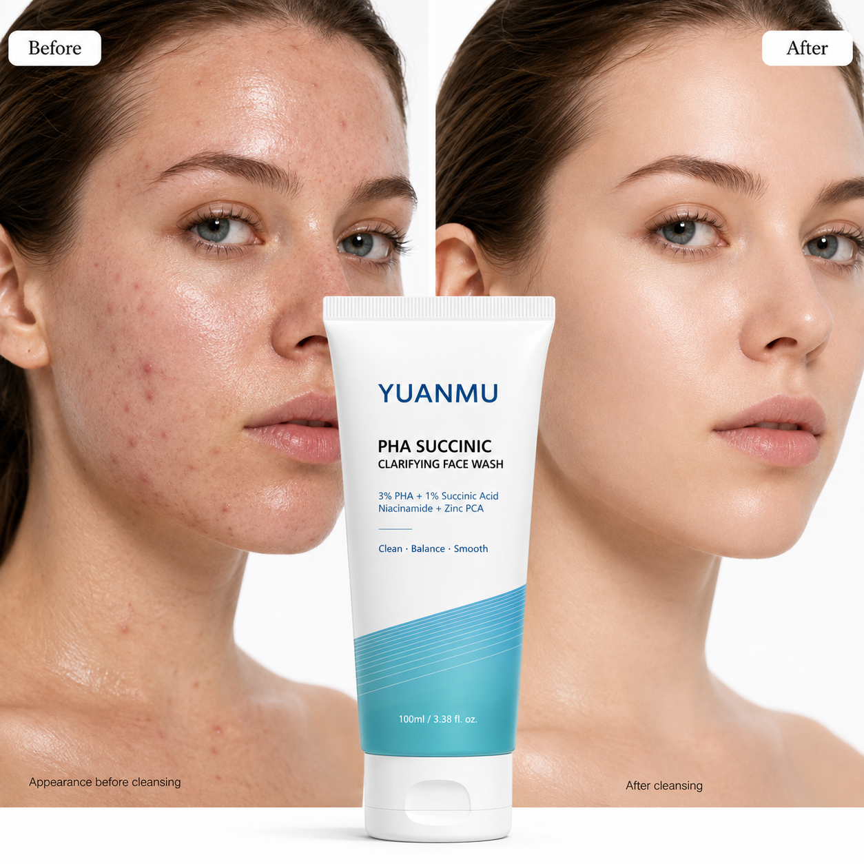 PHA + Limpieza Facial Espumosa con Ácido Succínico