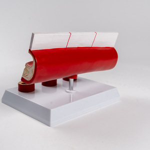 SCIEDU Age <strong>Group</strong> Large Blood Vessel Model 4 Parts <strong>Human</strong> Anatomy Model Sclerosis Cardiovascular Arteriosclerosis Pathology Model