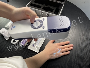 LANNX UVF 500A Alat Pencari Lokasi, Proyeksi Medis Vein Viewer, Perangkat Detektor Vaskular, Klinik Iluminator Rumah Sakit, Pencari Pembuluh Darah Portabel - Product Image 2