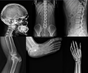 Careray x Ray phẳng Detector/radiology hình ảnh chẩn đoán không dây Dr kỹ thuật số phẳng Detector - Product Image 6