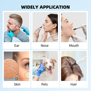 Chất lượng cao bebird thiết kế mới nhất R1 1080P WIFI thú y nội soi tai otoscope sáp Tai Remover với máy ảnh - Product Image 5