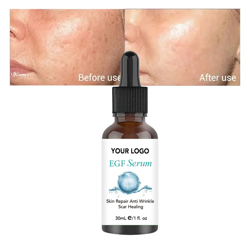 Nouveau sérum blanchissant anti-âge éliminant les taches brunes sérum à la vitamine C pour le visage avec marque privée à l'acide hyaluronique
