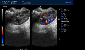 Dawei-sistema ultrasónico de Color para uso veterinario, imagen en tiempo Real 4d portátil de alta gama - Product Image 5