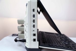 <span class=keywords><strong>Machine</strong></span> à ultrasons portable Zoncare Medical Equipos De Ultrasonido Ecografo - Product Image 5