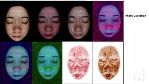 Thiết bị làm đẹp ai thông minh đầy màu sắc 3D chẩn đoán hình ảnh kỹ thuật số dermatoscope visia Máy quét mặt phân tích da 2025 - Product Image 3