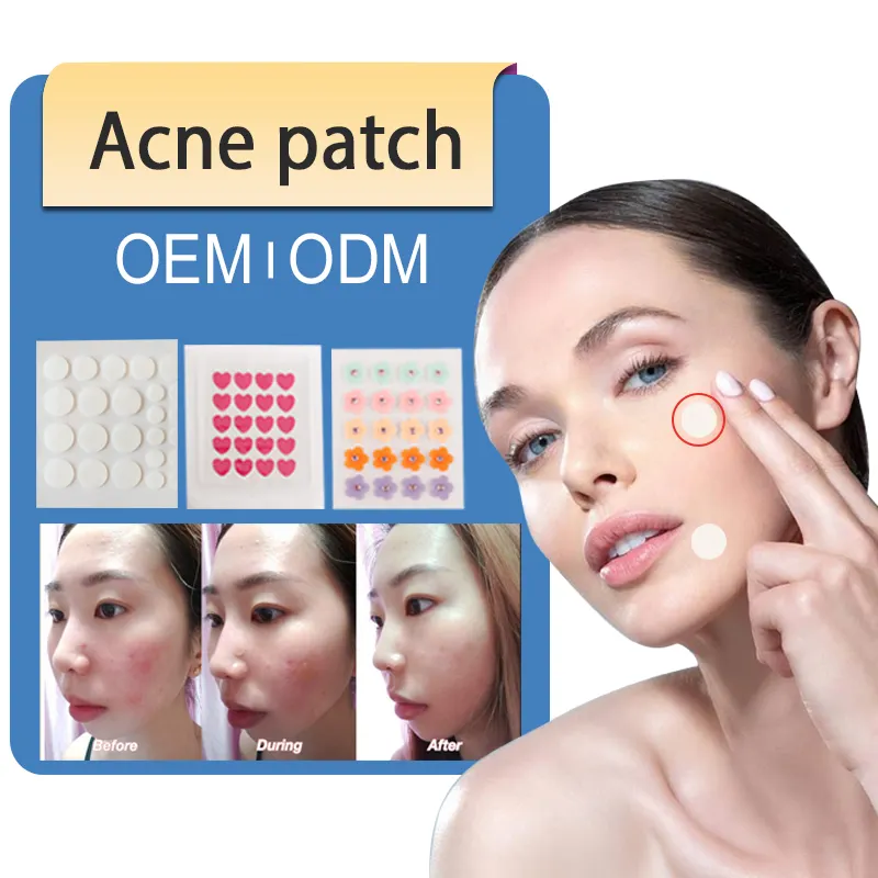 Factory Breathable Medical Grade Acne Pimple Silicone Face Scar Gel Removal Tape Sheet Patch