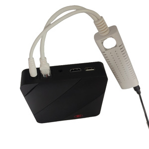 תמיכה m3u8 xtream קוד restekerx פורטל באינטרנט linux <span class=keywords><strong>iptv</strong></span> ethernet באינטרנט תיבת להתחבר עם יציאת סיבים