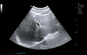 Système de diagnostic médical à ultrasons Doppler couleur 4D avec trois sondes - Product Image 2