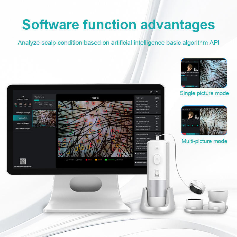ai scalp and hair scanner analyzer