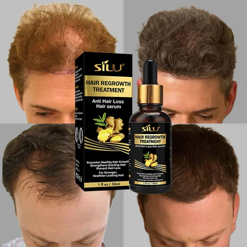 Oem ألياف الكيراتين العشبية الزنجبيل سيروم نمو الشعر منشط قوية إلى تنمو تساقط الشعر العلاج