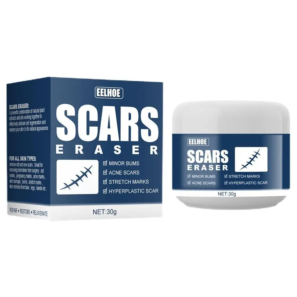 Pimples acne scar mark remover cream best cream for removing belly scars