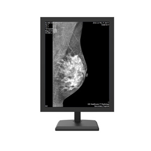 Alta Qualidade Equipamentos Médicos 5MP Grayscale Mammography Diagnostic Display - Product Image 2