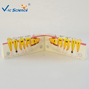 Mô hình giáo dục nha khoa mô hình răng người mô hình khoa học y tế ngay dưới buccal răng và tổn thương sâu răng - Product Image 4