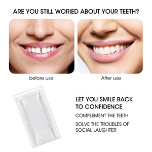 ชุดซ่อมแซมฟันเทียมแบบชั่วคราวที่แนะนำสำหรับหมอฟันแบบมีกาวติดแน่นแผ่นฟันขาว - Product Image 5
