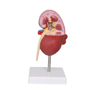 医療解剖学腎臓モデル拡大1.5X解剖学的腎腺疾患腎臓モデルヒト内臓器モデル - Product Image 4