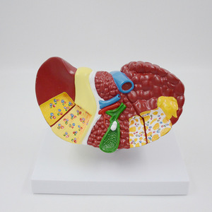 Tıbbi bilim insan organlarının karaciğer hasarı anatomik modeli karaciğer renk ayırma modeli tıbbi öğretim yardım modeli - Product Image 4