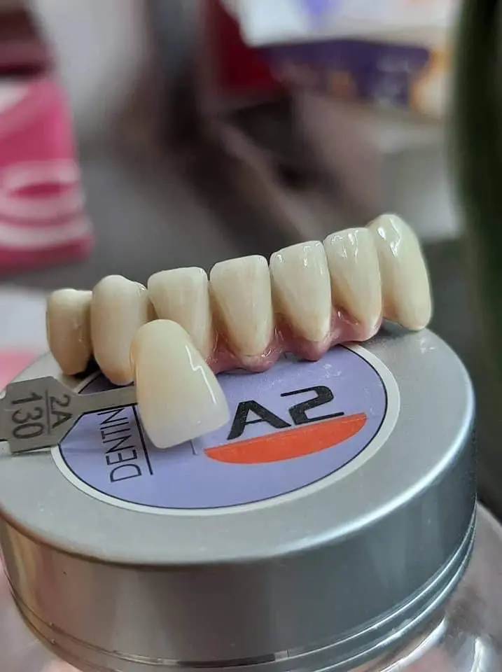 BAOT-cerámica metálica Dentin A1 A2 A3, materiales de laboratorio Dental para tratamiento Dental, porcelana en polvo, dentina, 50g