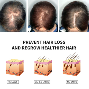 Penggunaan sehari-hari Rosemary Mint untuk kulit kepala & minyak penguat rambut meningkatkan sirkulasi darah memelihara kulit kepala 60ml minyak perawatan rambut MOOYAM - Product Image 2