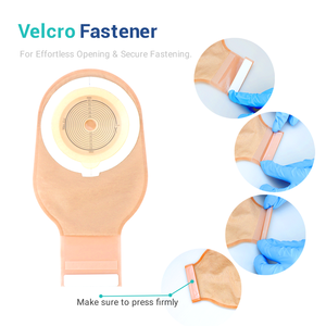 BLUENJOY peralatan medis, kantong kolostomi dapat dikeringkan satu bagian dengan penutup perekat dan Filter arang, tas Ostomy karbon - Product Image 1