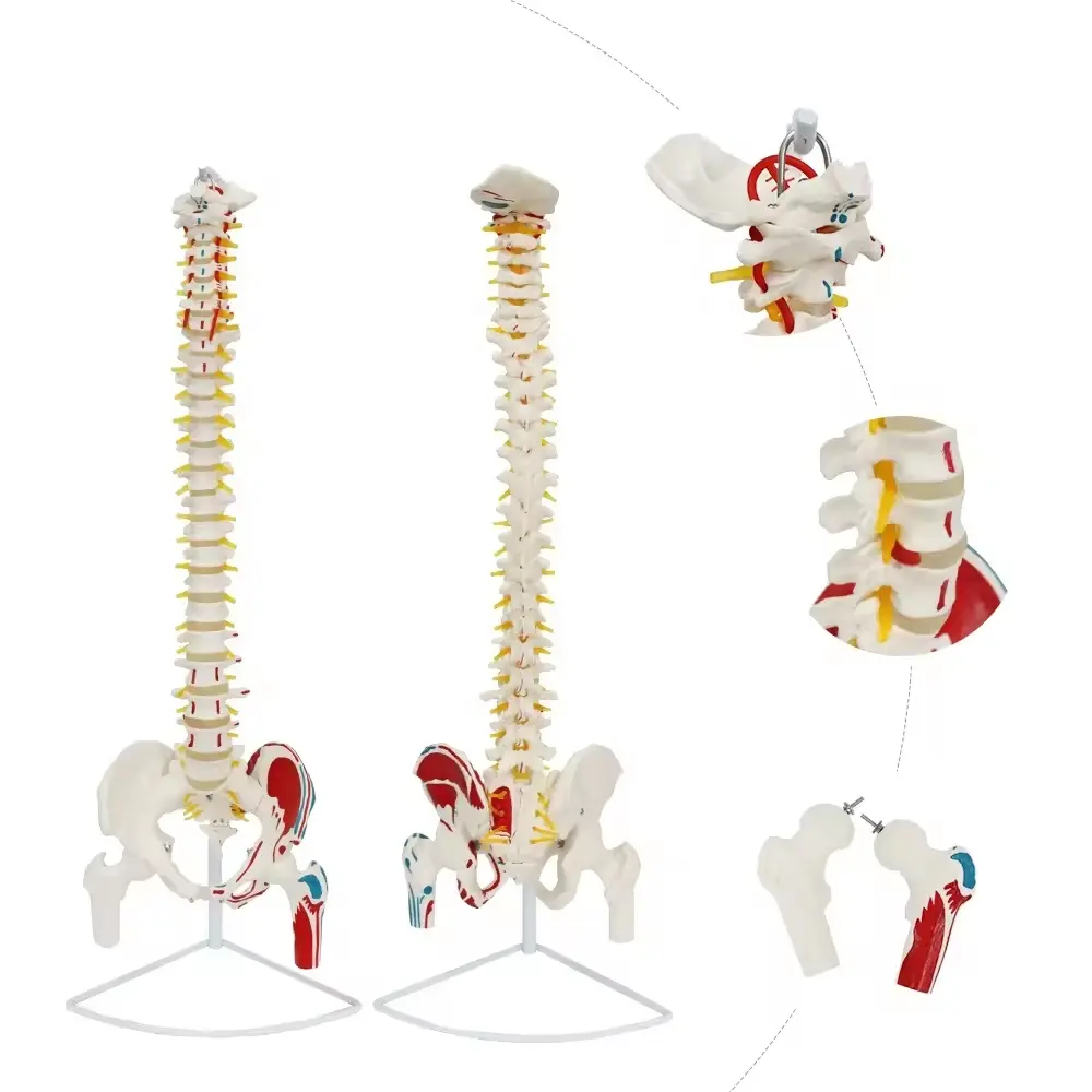 FOREST Human Spine Models 85cm Disc Herniation A Dobra Livre Do Nervo Espinhal Do Corpo Humano Ligado Ao Modelo De Anatomia Cervical Sp