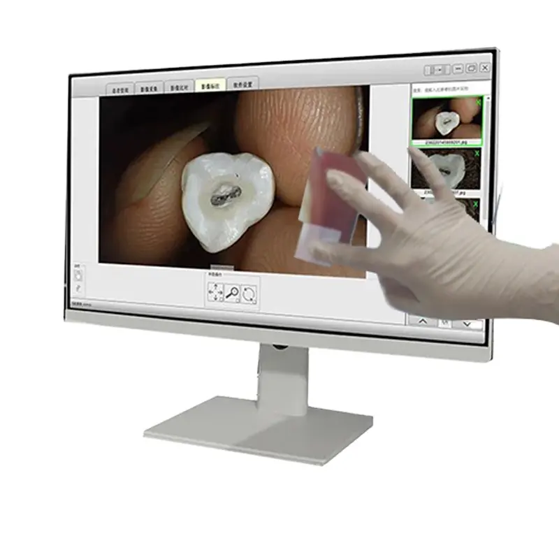 Moniteur à écran tactile de 24 pouces Visionneuse orale Endoscope wifi sans fil tout-en-un Équipement dentaire HD pour l'inspection des dents