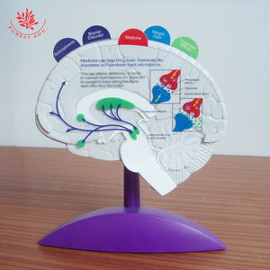 Epilepsi modeli İnsan beyin patoloji modeli anatomik eczane hediye - Product Image 4