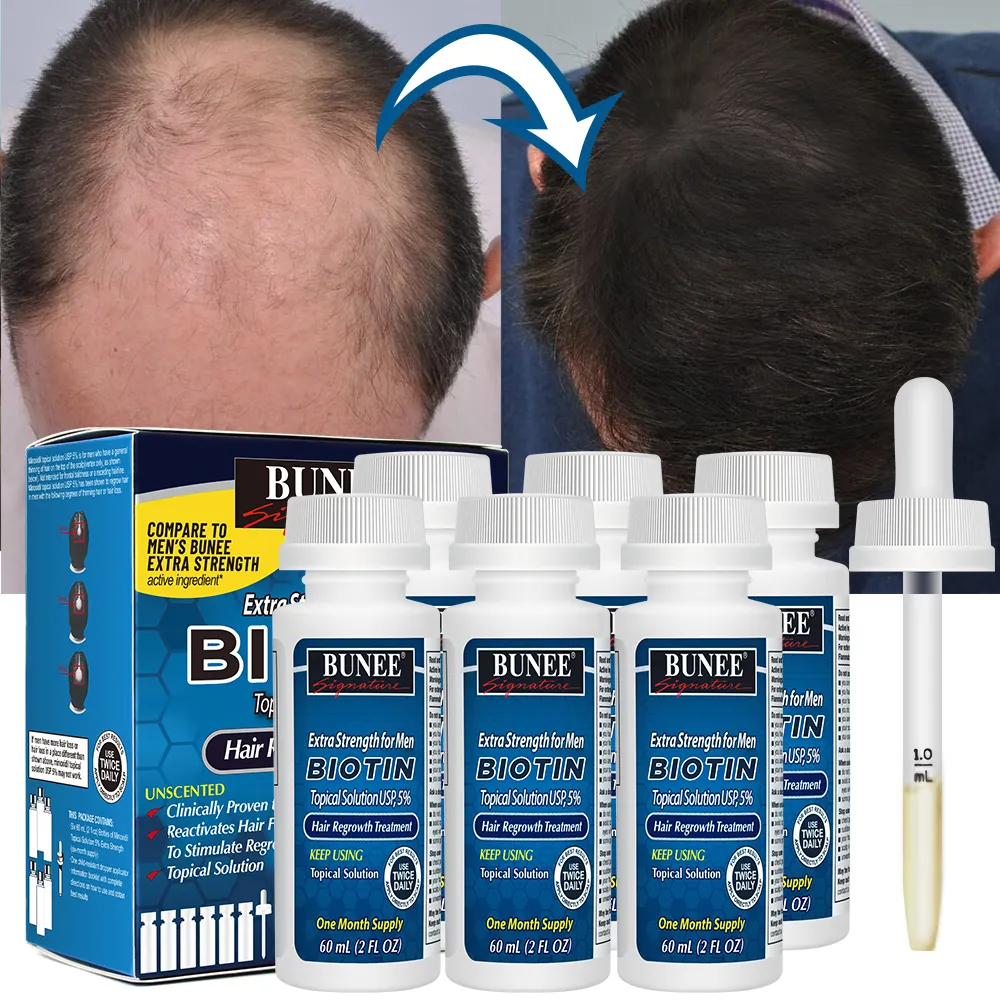 Биотин BUNEE 60 мл против выпадения, масло розмарина, касторовое масло, имбирь, коллаген, восстанавливает волосы, фолис, масло для роста волос, сыворотка