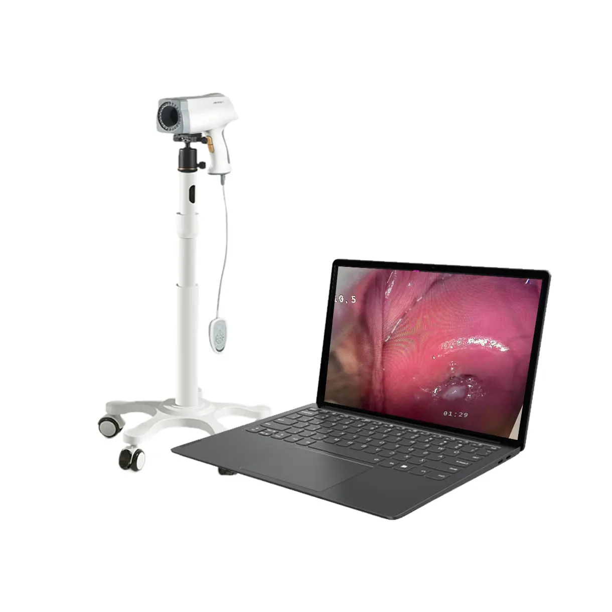 Endoscopio médico Colposcopio portátil Camara vaginal HD Portatil Colposcopio de video digital para Ginecología